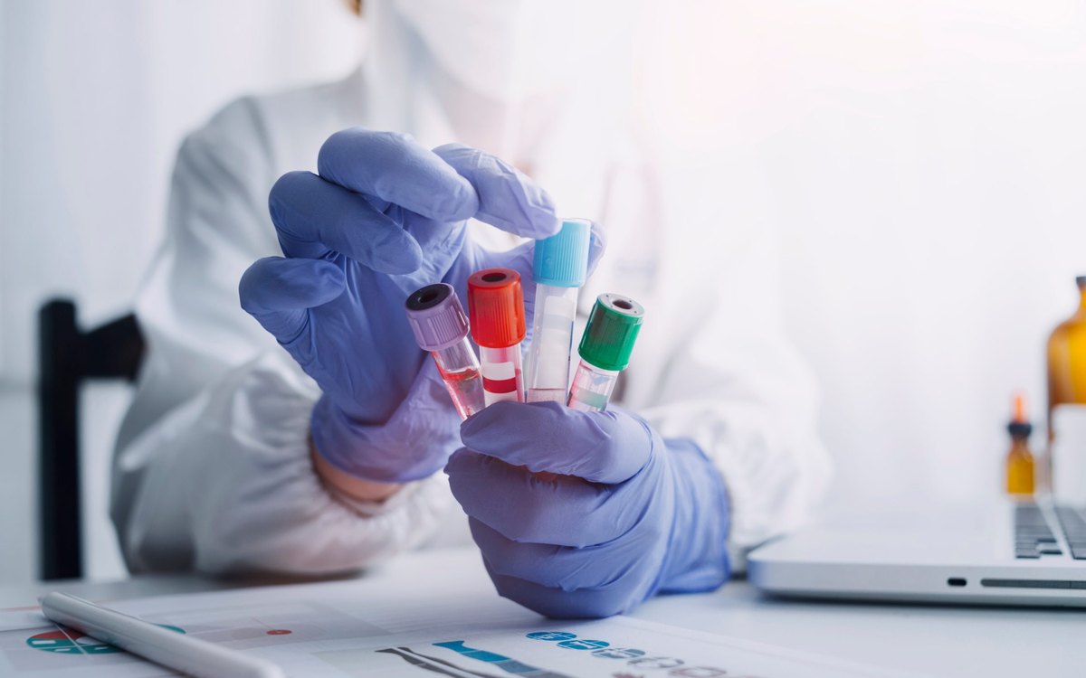 Laboratory technologist taking a blood sample tube from a rack beside analysers in a hematology laboratory