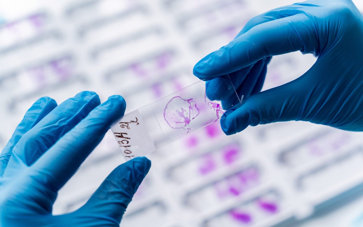 Gloved hand holding glass histology slides in a pathology laboratory